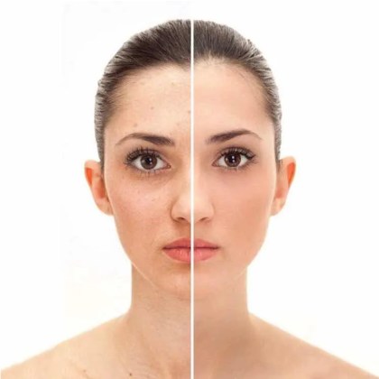 κρέμα-σαλιγκαριού-skin-repairing-snail-cream-99-115g