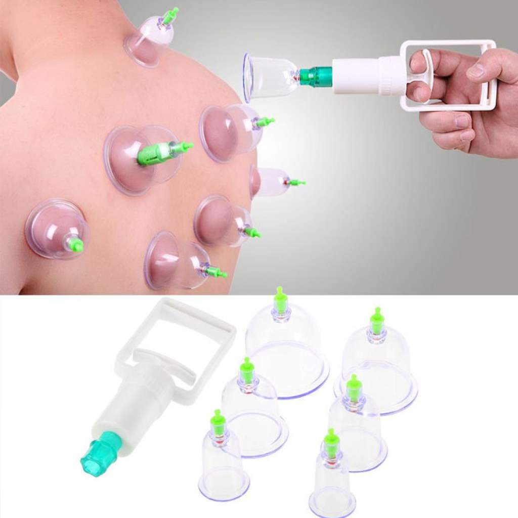 Ποτήρια Θεραπείας και Μασάζ 12 Τεμαχίων 